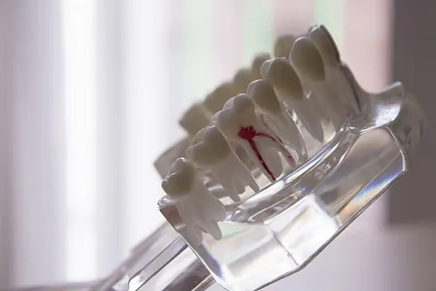 dentadura de metacrilato para mostrar a pacientes